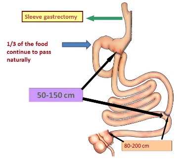 Transit Bipartition